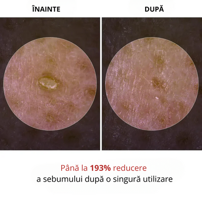 RALVINO - SER EXFOLIANT CONCENTRAT CU OREZ