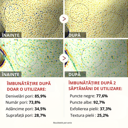 RALVINO - SER EXFOLIANT CONCENTRAT CU OREZ